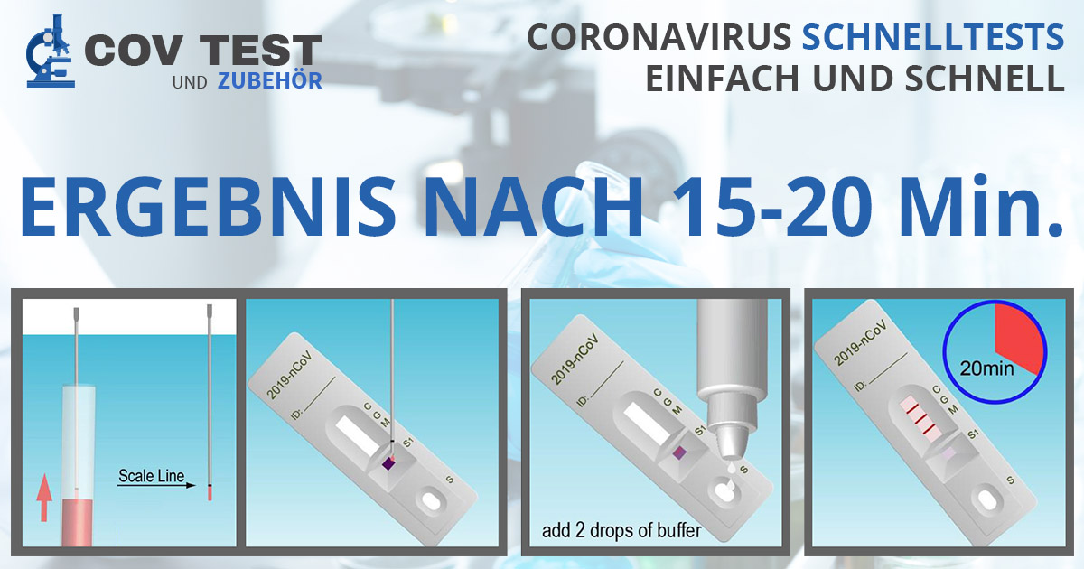 Coronavirus COVID-19 Schnelltest - Ohne Laboreinrichtung ...